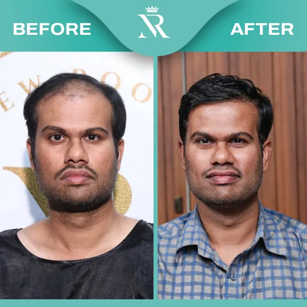 Sapphire HT Result 03 - Feb 26