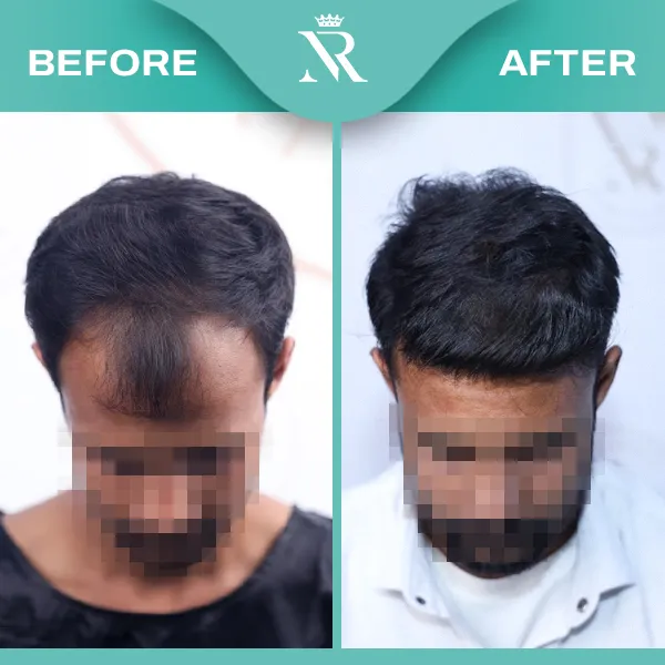 Sapphire HT Result 05 - Feb 26