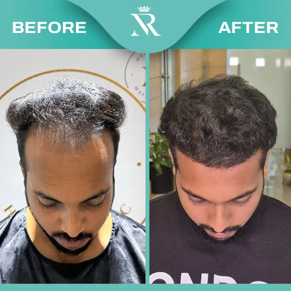 Sapphire HT Result 06 - Feb 26